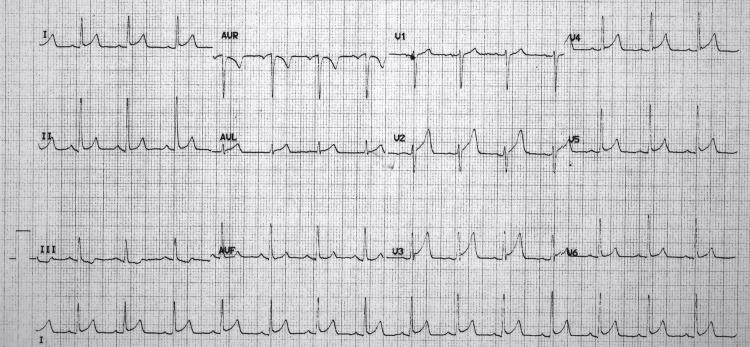 https://cdn.ncbi.nlm.nih.gov/pmc/blobs/3d0b/10113064/69084055ca60/cureus-0015-00000037794-i04.jpg
