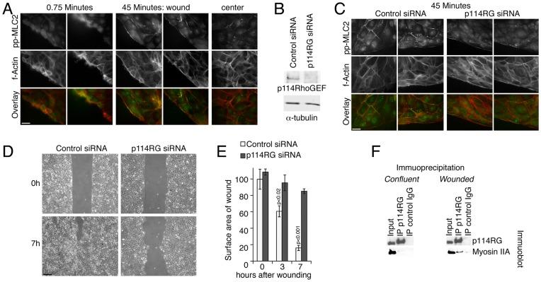 https://cdn.ncbi.nlm.nih.gov/pmc/blobs/3d0f/3501466/b01c732087c9/pone.0050188.g001.jpg