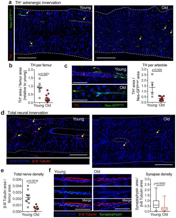 https://cdn.ncbi.nlm.nih.gov/pmc/blobs/3d13/6095812/960e19fb4c10/nihms950683f2.jpg