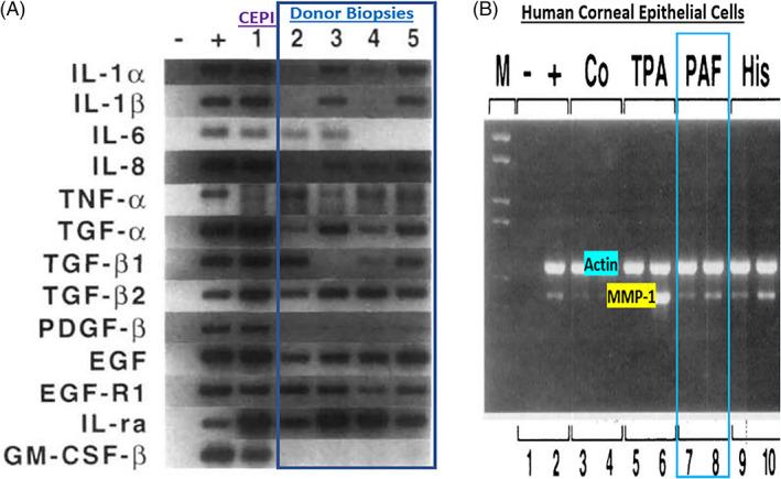 https://cdn.ncbi.nlm.nih.gov/pmc/blobs/3d15/10084252/7163e97d06d6/BIOF-48-1226-g017.jpg