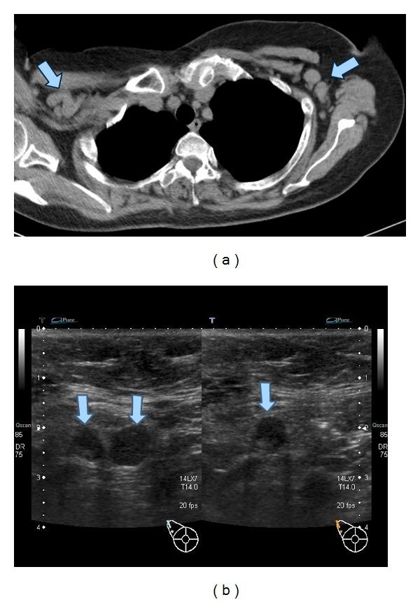 https://cdn.ncbi.nlm.nih.gov/pmc/blobs/3d15/4009268/20e33ec1f7e8/CRIRH2014-386328.001.jpg