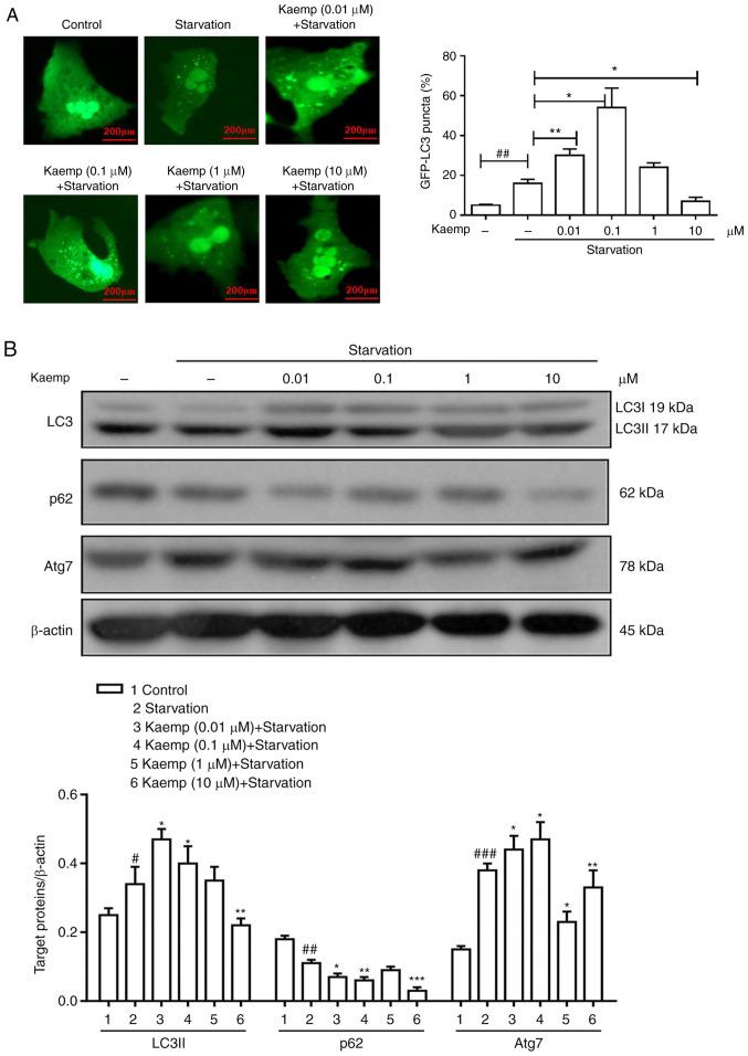 https://cdn.ncbi.nlm.nih.gov/pmc/blobs/3d15/8335584/18d5abdeb0fe/mmr-24-03-12321-g03.jpg