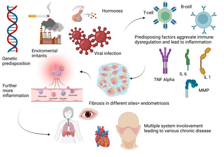 https://cdn.ncbi.nlm.nih.gov/pmc/blobs/3d17/10445410/4ad1d198fad3/cureus-0015-00000042362-i03.jpg