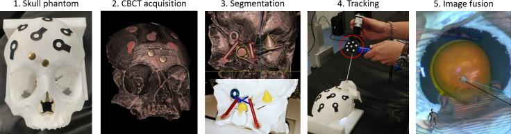 https://cdn.ncbi.nlm.nih.gov/pmc/blobs/3d1d/6964902/53eb975c2ac2/pone.0227312.g004.jpg