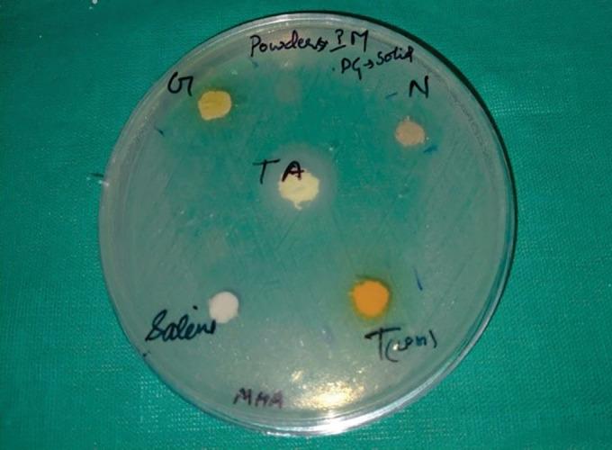 https://cdn.ncbi.nlm.nih.gov/pmc/blobs/3d21/11320791/b26a7371ea5f/ijcpd-17-285-g001.jpg