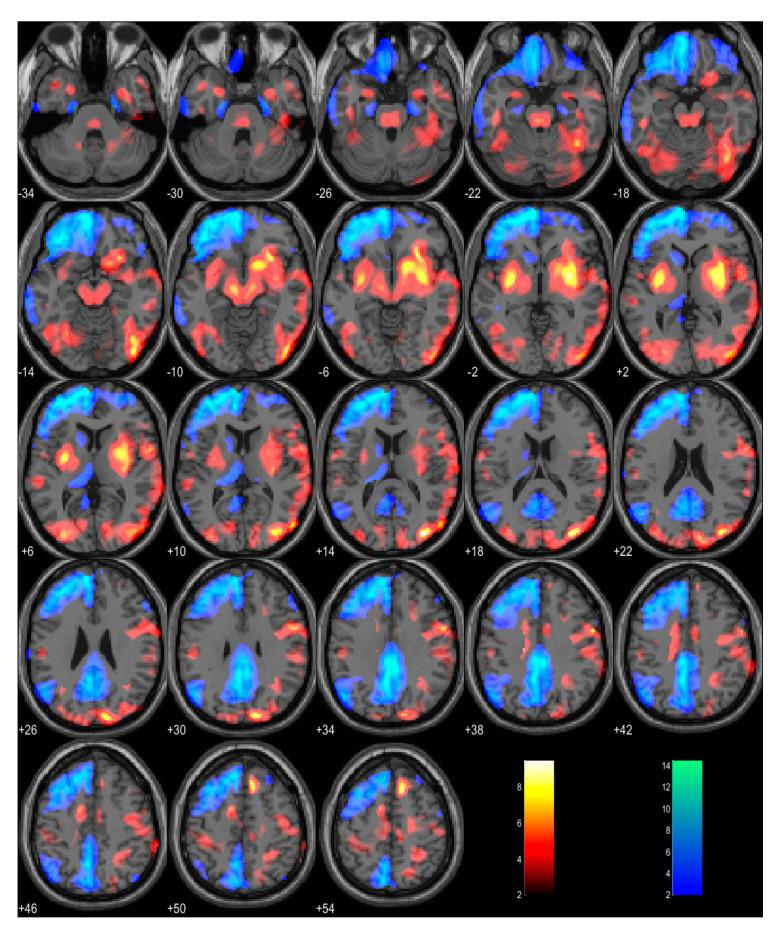 https://cdn.ncbi.nlm.nih.gov/pmc/blobs/3d23/10488131/715ee237f16b/ijms-24-13081-g001.jpg