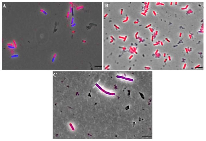 https://cdn.ncbi.nlm.nih.gov/pmc/blobs/3d24/8950343/0192f0a6f69b/membranes-12-00269-g004.jpg