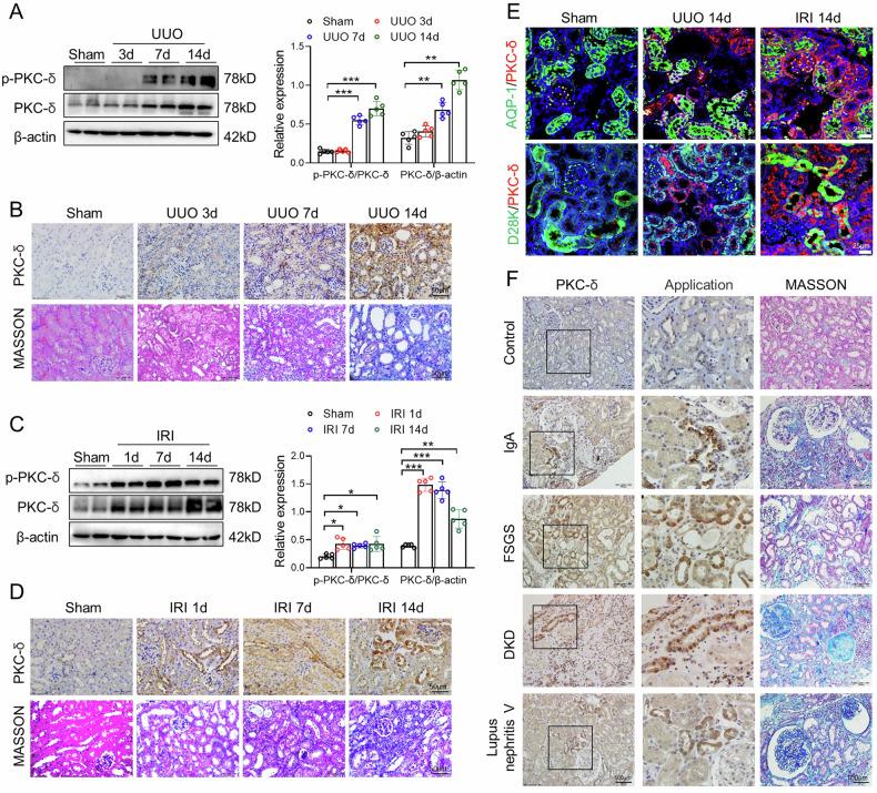 https://cdn.ncbi.nlm.nih.gov/pmc/blobs/3d25/11228024/74184ab3a5cd/41420_2024_2087_Fig1_HTML.jpg