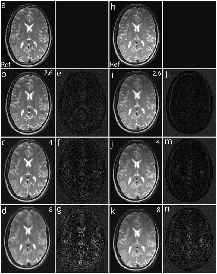 https://cdn.ncbi.nlm.nih.gov/pmc/blobs/3d27/4429034/2af266cc1970/pone.0126386.g014.jpg