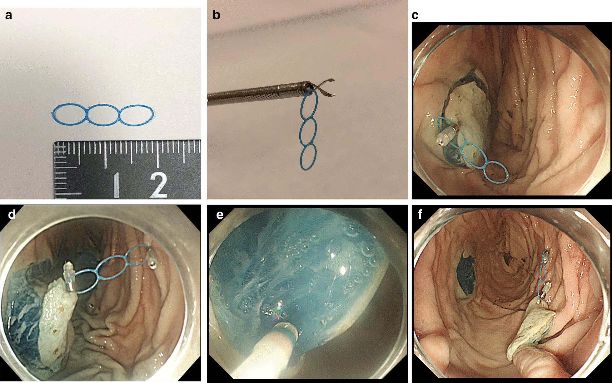 https://cdn.ncbi.nlm.nih.gov/pmc/blobs/3d27/8740506/f1d00796fba2/12876_2021_2085_Fig1_HTML.jpg