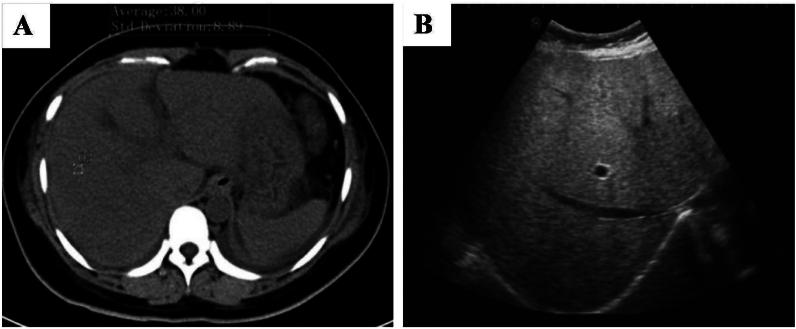 https://cdn.ncbi.nlm.nih.gov/pmc/blobs/3d2a/12212678/21819a3fbf63/gr6.jpg
