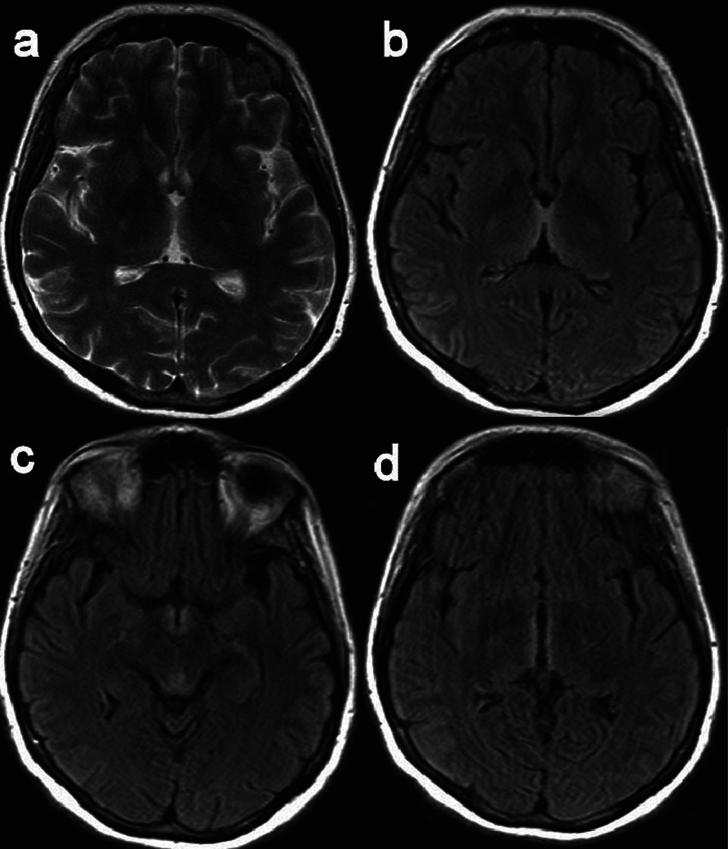 https://cdn.ncbi.nlm.nih.gov/pmc/blobs/3d2a/12212678/bfa4357facb6/figs1.jpg