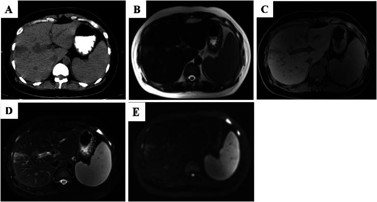 https://cdn.ncbi.nlm.nih.gov/pmc/blobs/3d2a/12212678/c111987ccdb6/gr5.jpg