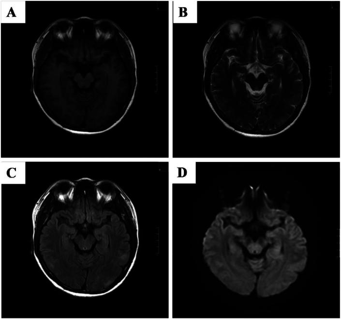 https://cdn.ncbi.nlm.nih.gov/pmc/blobs/3d2a/12212678/fa6e8134d1c6/gr4.jpg