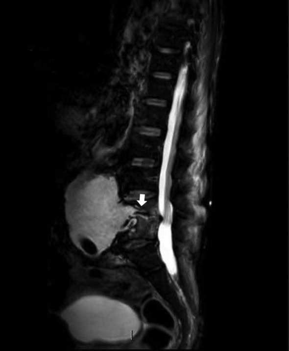 https://cdn.ncbi.nlm.nih.gov/pmc/blobs/3d2c/6159111/617c03730693/bjrcr.20170101.g004.jpg