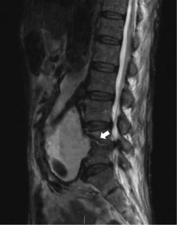 https://cdn.ncbi.nlm.nih.gov/pmc/blobs/3d2c/6159111/f26c7ecda2e8/bjrcr.20170101.g005.jpg