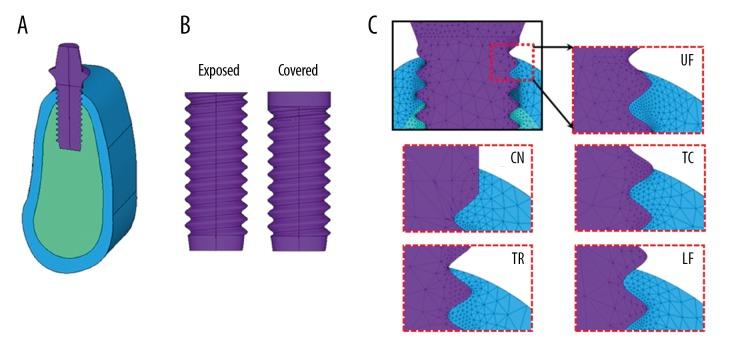 https://cdn.ncbi.nlm.nih.gov/pmc/blobs/3d2f/6556072/c48494432981/medscimonit-25-3933-g001.jpg