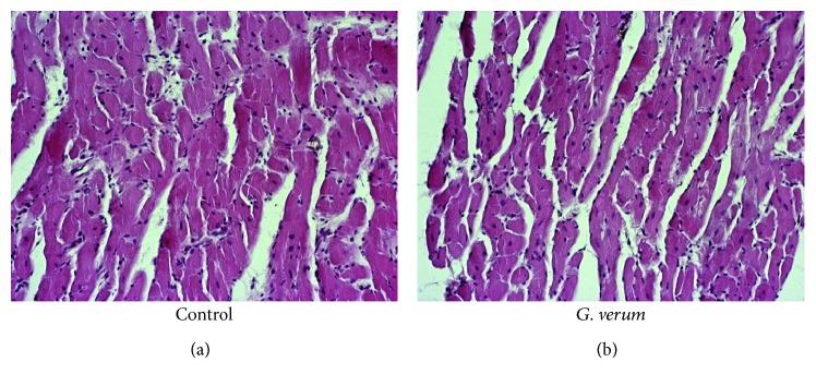https://cdn.ncbi.nlm.nih.gov/pmc/blobs/3d31/6378796/c1ca5ac7026e/OMCL2019-4235405.006.jpg