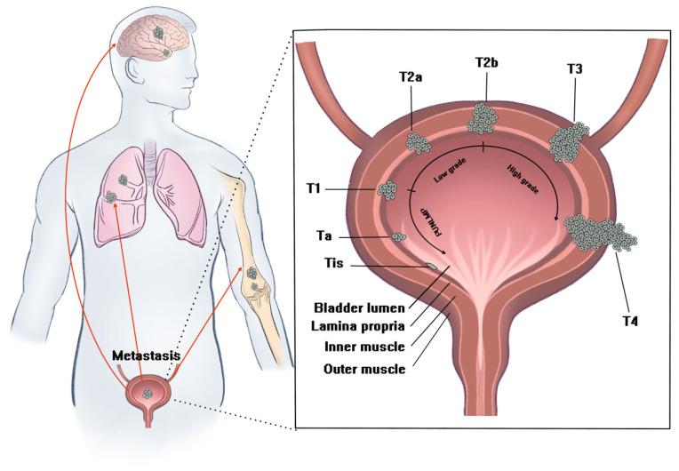 https://cdn.ncbi.nlm.nih.gov/pmc/blobs/3d36/9599190/e349938656b8/biosensors-12-00796-g001.jpg