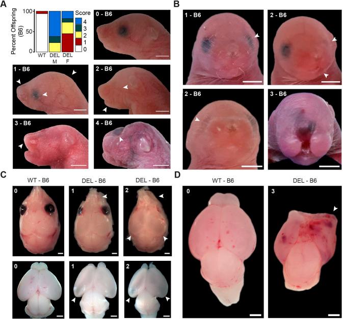 https://cdn.ncbi.nlm.nih.gov/pmc/blobs/3d3b/10655816/094c810fe8b2/dmm-15-049752-g4.jpg