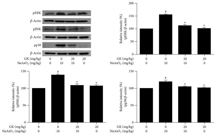 https://cdn.ncbi.nlm.nih.gov/pmc/blobs/3d3c/5516716/3b746bebf50d/ECAM2017-8137627.007.jpg