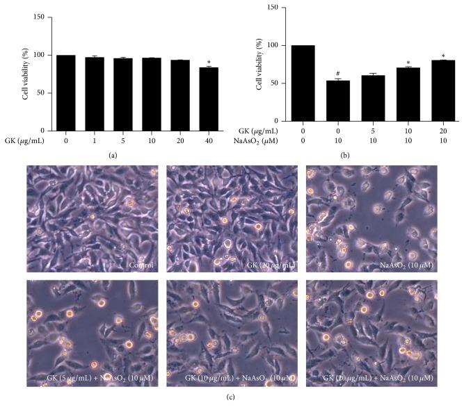 https://cdn.ncbi.nlm.nih.gov/pmc/blobs/3d3c/5516716/ca923c9cbc5b/ECAM2017-8137627.001.jpg
