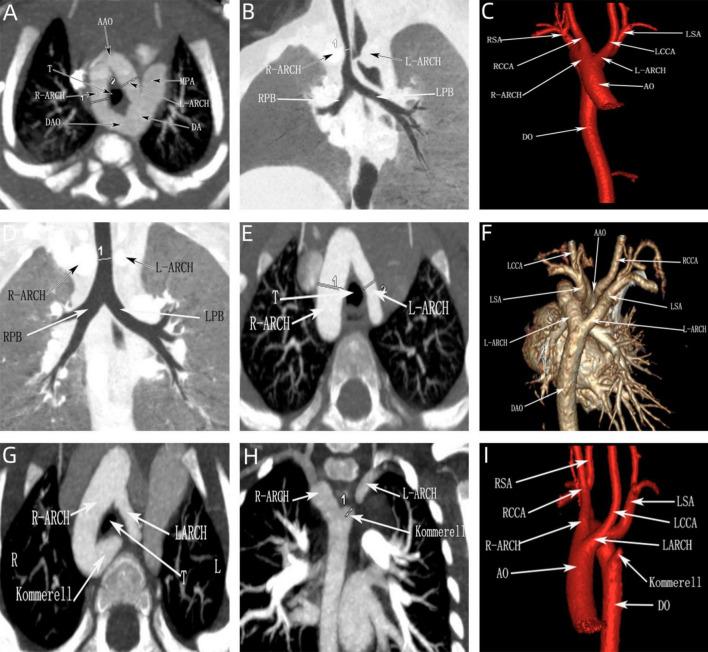 https://cdn.ncbi.nlm.nih.gov/pmc/blobs/3d3d/11392772/03e919578e1c/fmed-11-1398623-g008.jpg