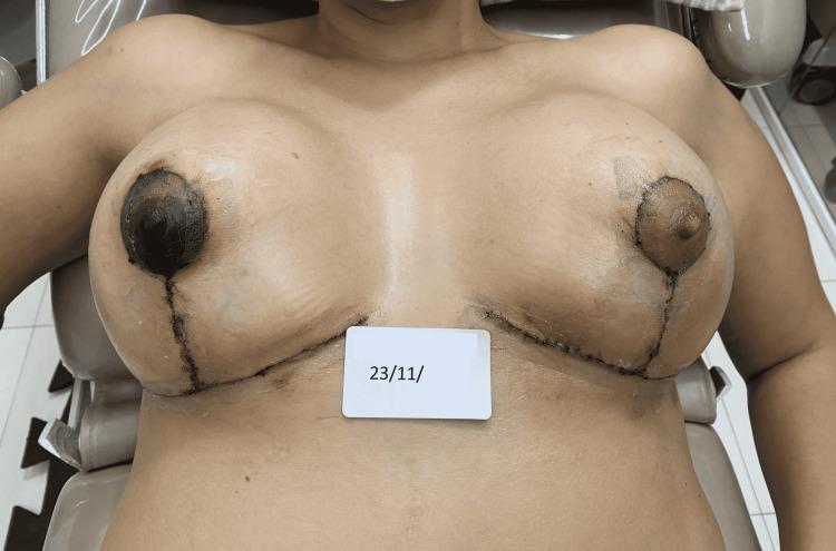 https://cdn.ncbi.nlm.nih.gov/pmc/blobs/3d45/9167639/95db613651c9/cureus-0014-00000025666-i06.jpg