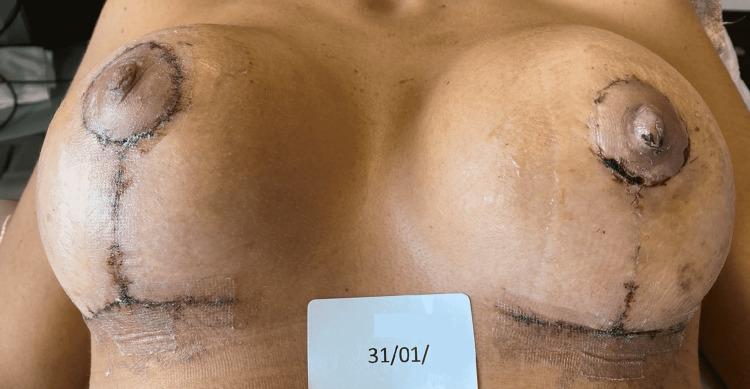 https://cdn.ncbi.nlm.nih.gov/pmc/blobs/3d45/9167639/f50b75786ae9/cureus-0014-00000025666-i03.jpg
