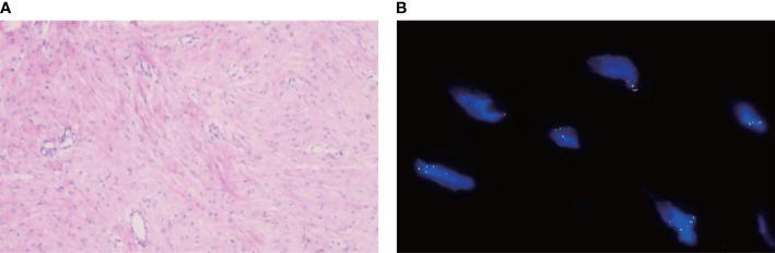 https://cdn.ncbi.nlm.nih.gov/pmc/blobs/3d48/8792388/181f0aa1c236/fonc-11-830672-g001.jpg