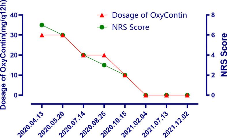 https://cdn.ncbi.nlm.nih.gov/pmc/blobs/3d48/8792388/25ae94ca3cfd/fonc-11-830672-g004.jpg