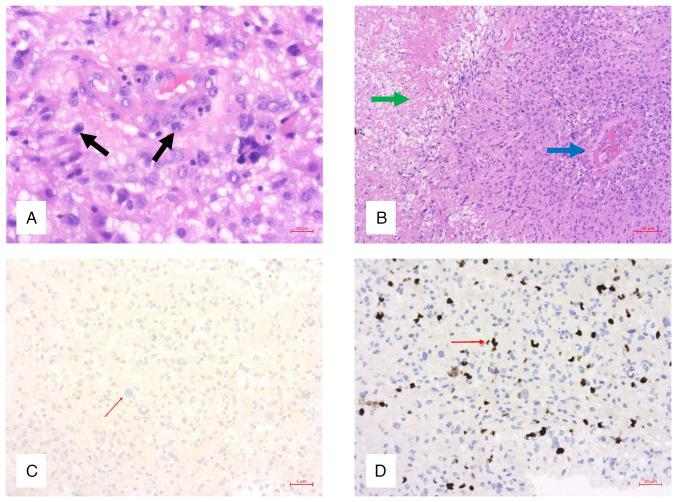 https://cdn.ncbi.nlm.nih.gov/pmc/blobs/3d4a/10996027/69c0a06a22ba/ol-27-05-14363-g00.jpg