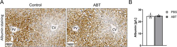 https://cdn.ncbi.nlm.nih.gov/pmc/blobs/3d4b/9584869/811b000ad632/204_2022_3395_Fig6_HTML.jpg