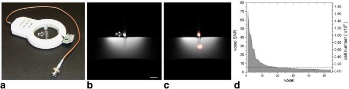 https://cdn.ncbi.nlm.nih.gov/pmc/blobs/3d4d/4253123/91044c6d304e/mrm0072-1696-f2.jpg