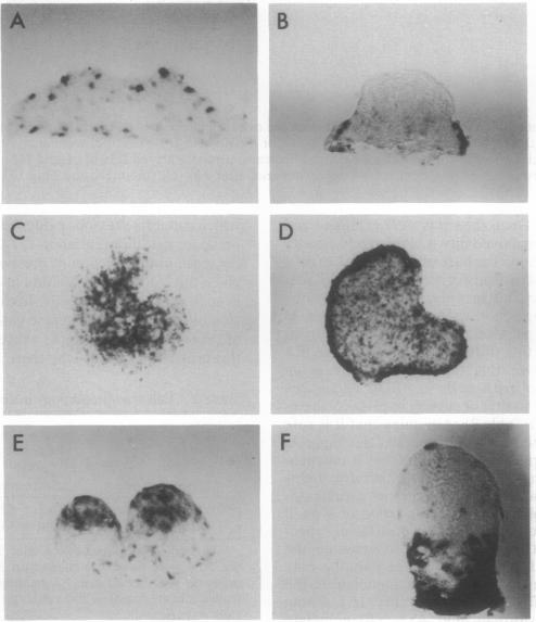 https://cdn.ncbi.nlm.nih.gov/pmc/blobs/3d4f/49906/17420000667c/pnas01091-0466-b.jpg