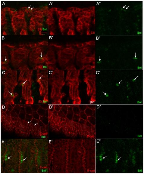 https://cdn.ncbi.nlm.nih.gov/pmc/blobs/3d5b/2994725/3dcec4e20171/pone.0014134.g009.jpg