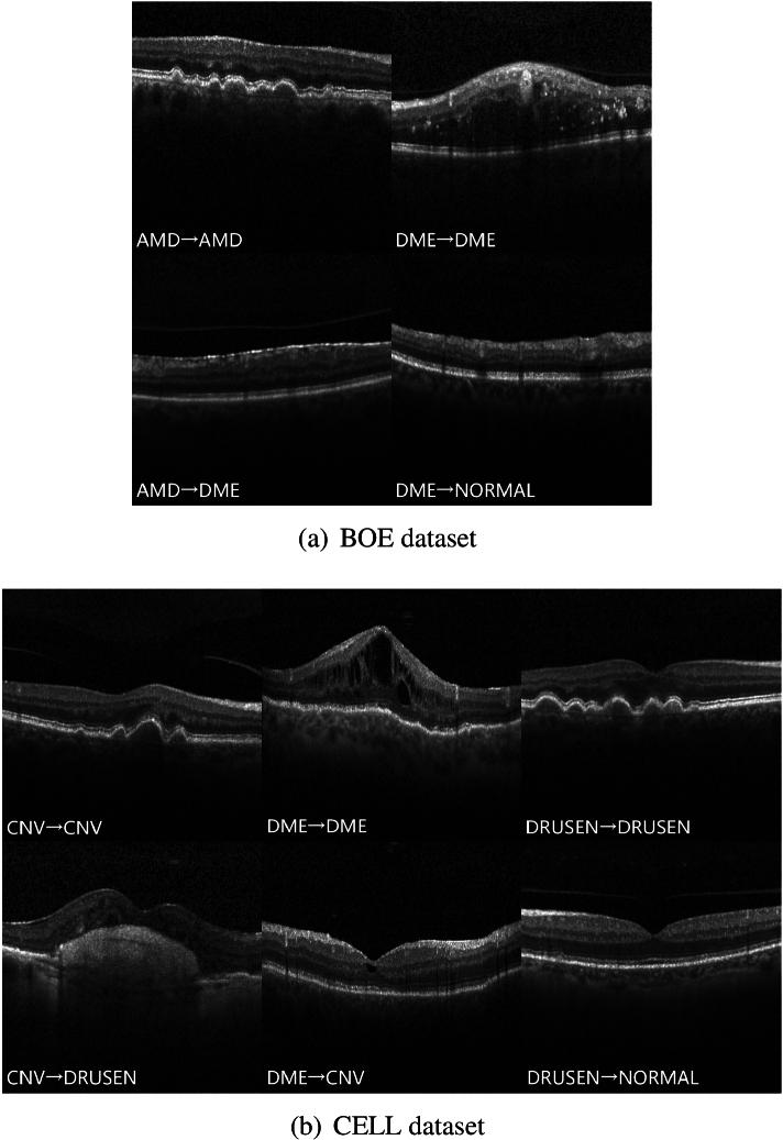 https://cdn.ncbi.nlm.nih.gov/pmc/blobs/3d62/11427199/99fad7cbf404/boe-15-8-4980-g006.jpg