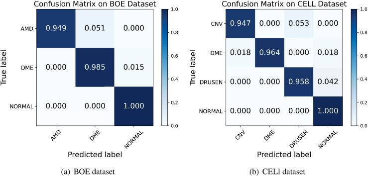https://cdn.ncbi.nlm.nih.gov/pmc/blobs/3d62/11427199/e254ae82acdb/boe-15-8-4980-g005.jpg