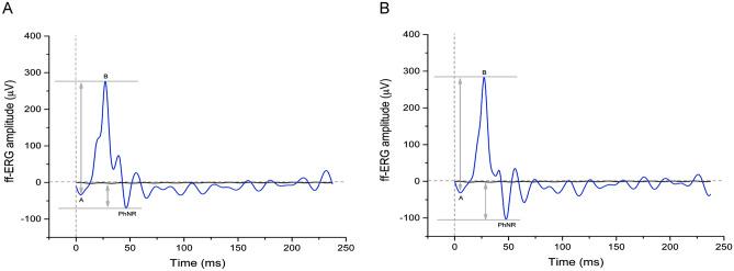 https://cdn.ncbi.nlm.nih.gov/pmc/blobs/3d62/9474814/69f28f0cb8fb/41598_2022_19925_Fig2_HTML.jpg