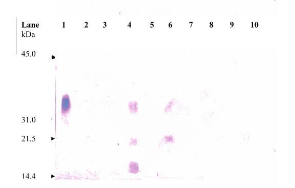 https://cdn.ncbi.nlm.nih.gov/pmc/blobs/3d67/1182232/e15ca41e755e/ijbsv01p0103g06.jpg