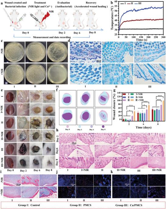 https://cdn.ncbi.nlm.nih.gov/pmc/blobs/3d68/10288238/de31332ca881/ADVS-10-2207342-g004.jpg