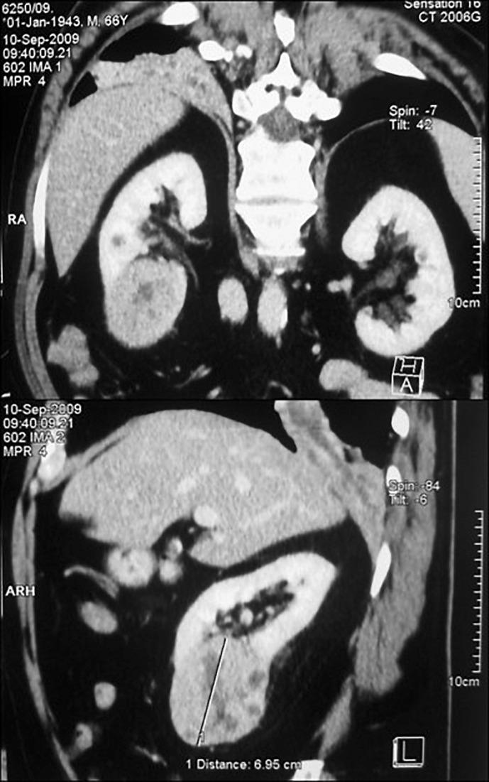 https://cdn.ncbi.nlm.nih.gov/pmc/blobs/3d6c/10950357/839646ff660d/cro-2024-0017-0001-537860_F03.jpg