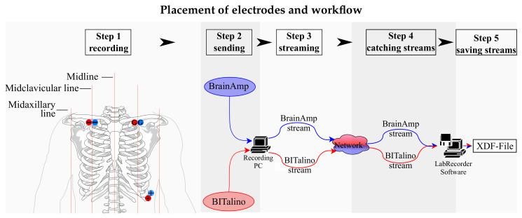 https://cdn.ncbi.nlm.nih.gov/pmc/blobs/3d6f/8271611/eced222b2eba/sensors-21-04485-g001.jpg