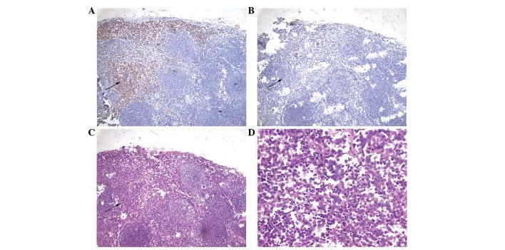 https://cdn.ncbi.nlm.nih.gov/pmc/blobs/3d70/3576198/07f668a52e52/OL-05-03-0768-g01.jpg