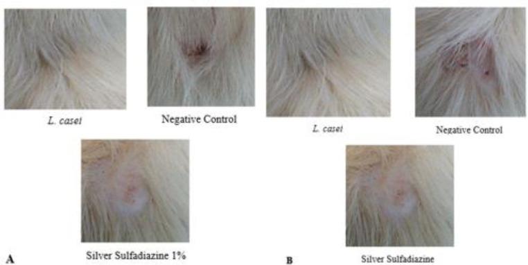 https://cdn.ncbi.nlm.nih.gov/pmc/blobs/3d74/8061325/adfc946f67db/IJBMS-24-143-g005.jpg