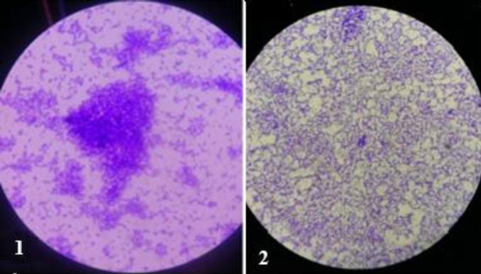 https://cdn.ncbi.nlm.nih.gov/pmc/blobs/3d74/8061325/b48335ddbe28/IJBMS-24-143-g003.jpg