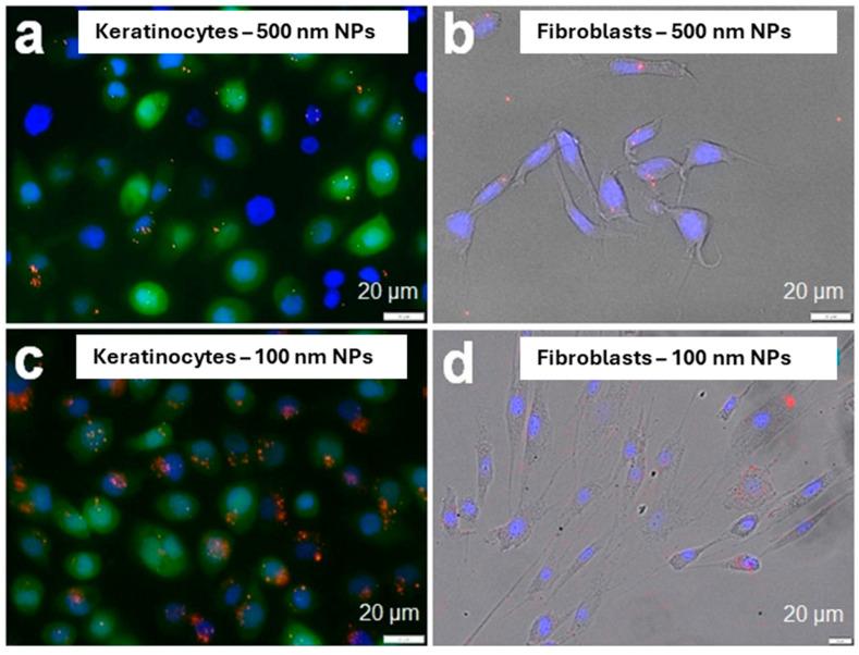 https://cdn.ncbi.nlm.nih.gov/pmc/blobs/3d75/11755607/cbe1552c23d0/jox-15-00006-g006.jpg