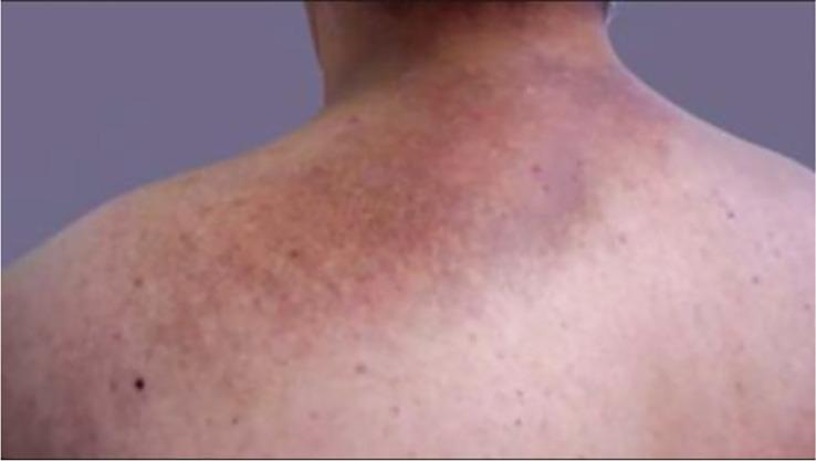 https://cdn.ncbi.nlm.nih.gov/pmc/blobs/3d76/10214500/547033b2572a/fendo-14-1167890-g009.jpg