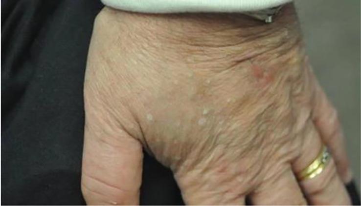 https://cdn.ncbi.nlm.nih.gov/pmc/blobs/3d76/10214500/7c70eadf075d/fendo-14-1167890-g013.jpg