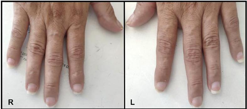 https://cdn.ncbi.nlm.nih.gov/pmc/blobs/3d76/10214500/8bb617bfe721/fendo-14-1167890-g003.jpg